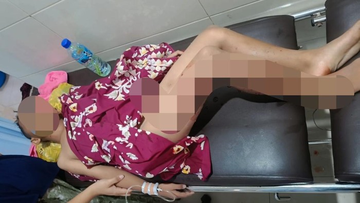 Muhamad Rizki Alfarido (9) terbaring di puskesmas setelah diserang anjing liar di Desa Terara, Lombok Timur, NTB, Senin (22/9/2025). (Dok. Polres Lombok Timur)