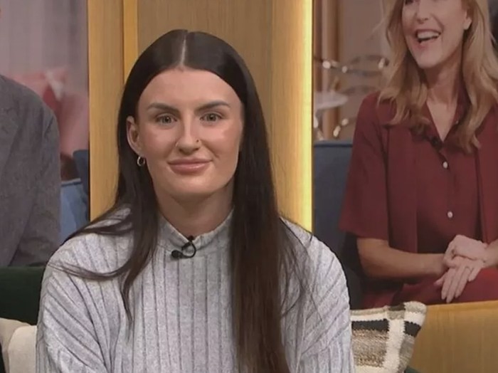 Wanita Ini Alami Alergi Air