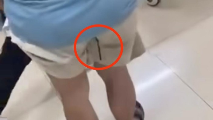 Anak panah busur tertancap pada pantat korban bernama Zafwan di Kota Makassar.