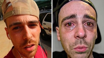 Jaystation, atau Jason Ethier, membangun karier YouTube dengan tantangan 24 jam menyusup ke bisnis dan video trespassing palsu. Puncak kontroversi terjadi awal 2020: ia memalsukan kematian pacarnya, Alexia Marano, lewat video My Girlfriend Alexia D**d… Rest In Paradise untuk 5,4 juta subscriber. Ia bahkan buat video Ouija Board dengan tema itu.Hari kemudian, Ethier mengaku rekayasa, tapi Alexia membantah, tuduh Ethier manipulatif dan memaksa. Ethier balik tuduh dan klaim tak pernah memukulnya. YouTube hapus channel utamanya karena pelanggaran berulang; upaya channel baru gagal.Ia lanjut provokasi di Instagram, sebut COVID palsu dan tolak masker/vaksin. Kariernya runtuh total. Foto: Boredpanda