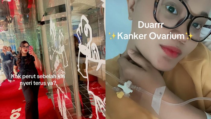 Viral Wanita Depok Kena Kanker Ovarium di Usia 25, Sempat Dikira Maag