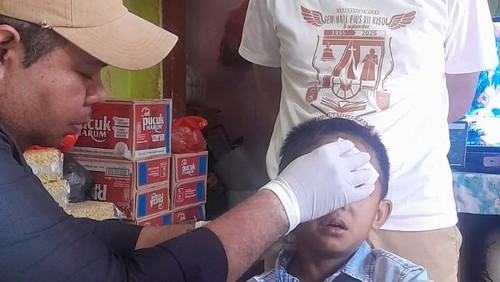 Kepala Dinas Kesehatan Kabupaten Manggarai, Safrianus Haryanto, saat memantau kondisi korban gigitan anjing di Kampung Purang, Desa golo Lambo, Kecamatan Satarmese, Manggarai, NTT, Minggu (28/9/3025). (Dok. Safrianus Haryanto)