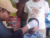 Balita Diserang Anjing Liar, Wajah hingga Kaki Digigit