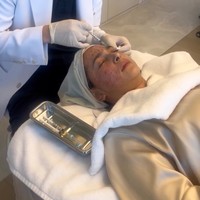 Prosedur tersebut tersebut melibatkan jarum berisi cairan stem cell yang ddiambil dari darah lalu disuntikkan berkali-kali ke wajah. Nabila pun terlihat menahan rasa sakit selama prosedur tersebut. Foto: Instagram/@nsyakieb85