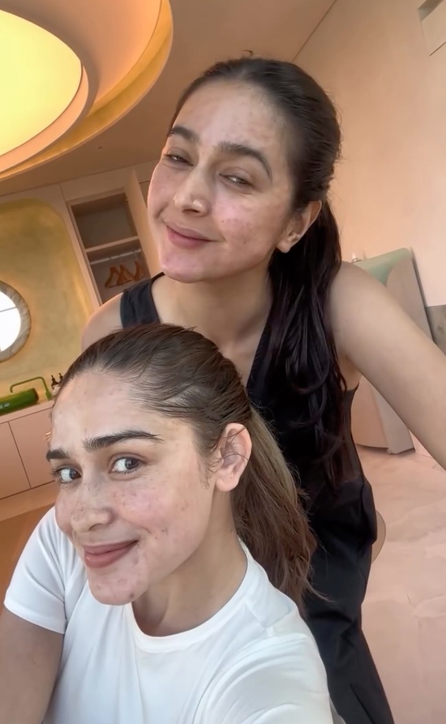 Terlihat setelah prosedur, kulit wajah Nabila dan Yasmine dipenuhi bentol-bentol merah akibat suntikan. Keduanya pun memamerkan wajah mereka. Foto: Instagram/@nsyakieb85