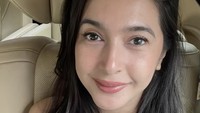 Wajah Nabila Syakieb dengan makeup setelah 7 hari melakukan stemcell therapy. Foto: Instagram @yaswildblood dan @nsyakieb85