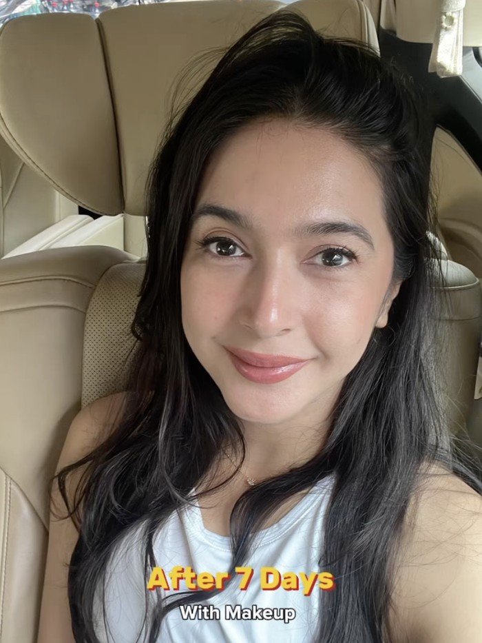 Nabila Syakieb dan Yasmine Wildblood Nabila Syakieb dan Yasmine Wildblood liburan sekaligus perawatan di Korea Selatan.