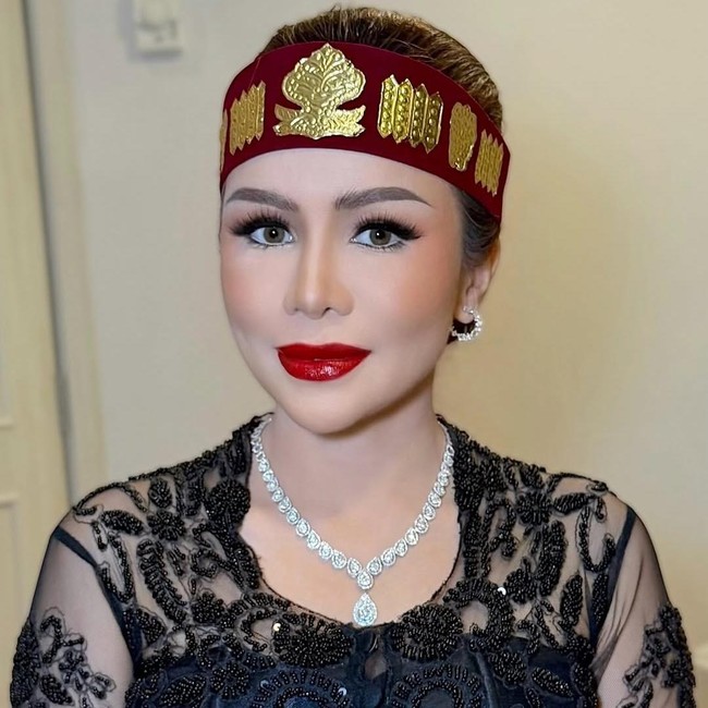 Momo Klarifikasi Unggahan Luka Lama di Instagram: Bukan untuk Geisha