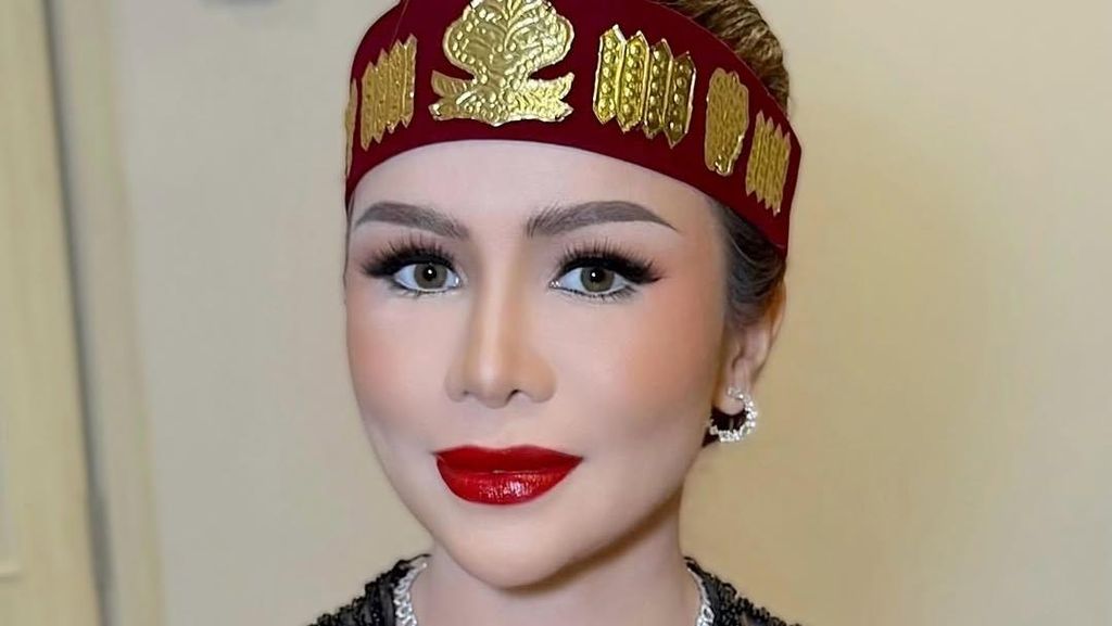 Momo Klarifikasi Unggahan Luka Lama di Instagram: Bukan untuk Geisha