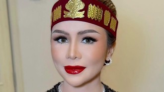 Momo Klarifikasi Unggahan Luka Lama di Instagram: Bukan untuk Geisha