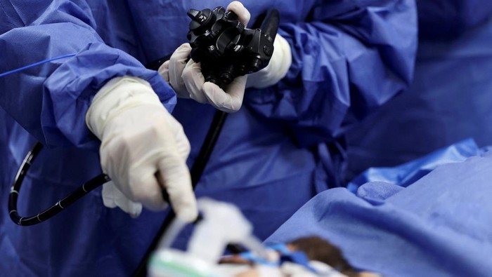 Egyptian Gastroenterologist Ahmad Madkour performs a new endoscopic procedure, dubbed as the 