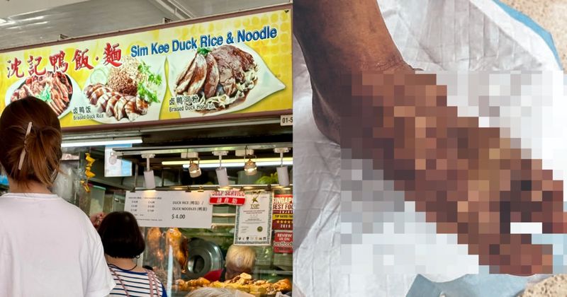 Gerai Nasi Bebek Legendaris Tutup usai Pemiliknya Tersiram Kuah Panas.