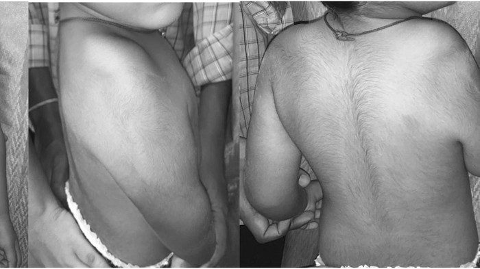 Anak india terlahir langka