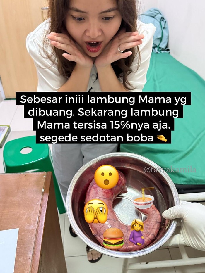 Tasya Kamila cerita ibunda gagal diet, obesitas, hingga operasi bariatrik.