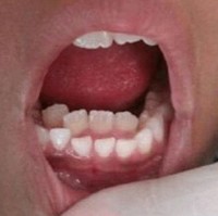 Fenomena Aneh Tubuh Bikin Takjub