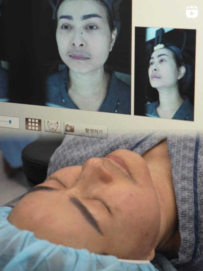 Pedangdut Iis Dahlia kembali bertolak ke Korea untuk mempercantik penampilannya. Kali ini ia memilih menjalani prosedur stem cell untuk meremajakan kulitnya. Foto: Instagram/@isdadahlia