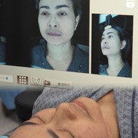 Pedangdut Iis Dahlia kembali bertolak ke Korea untuk mempercantik penampilannya. Kali ini ia memilih menjalani prosedur stem cell untuk meremajakan kulitnya. Foto: Instagram/@isdadahlia