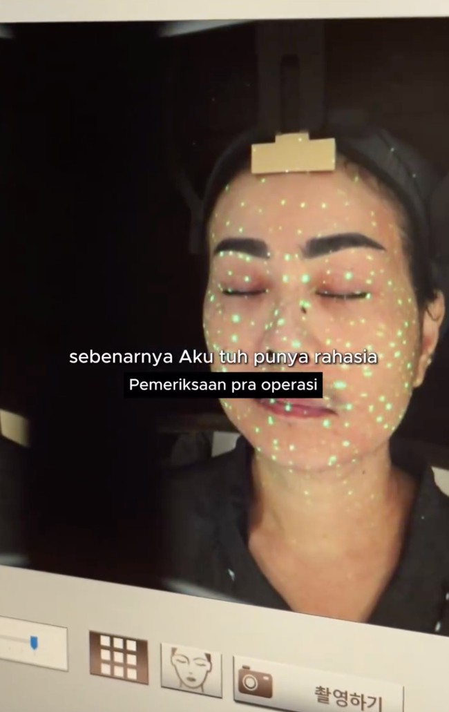 Seperti biasa, sebelum perawatan Iis melakukan beragam pemeriksaan dengan dokter yang akan menanganinya. Diketahui sebelumnya ibu 2 orang anak itu juga sudah pernah menjalani face lift di Korea untuk mengencangkan kulit wajahnya. Foto: Instagram/@isdadahlia