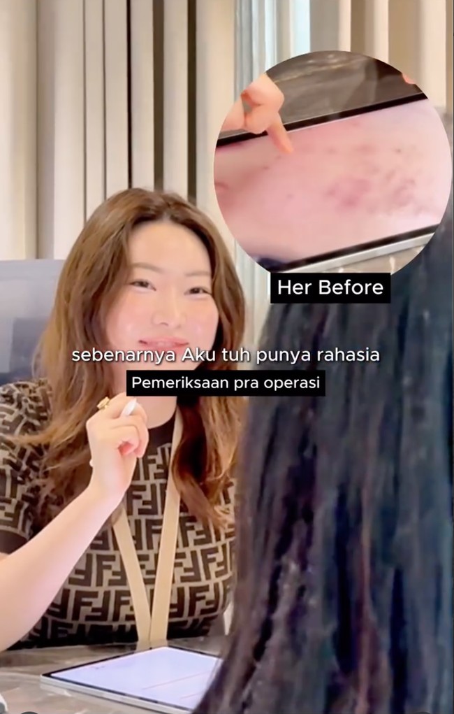 Iis pun membagikan hasil pemeriksaan kulitnya. Ternyata saat foto wajahnya di perbesar, terlihat jelas Iis memiliki flek dan kemerahan pada kulit wajahnya. Foto: Instagram/@isdadahlia