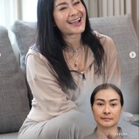 Setelah prosedur wajah Iis jelas terlihat jadi lebih cerah dan kinclong. Kerutan pun tak terlihat menghiasi wajah Iis. Foto: Instagram/@isdadahlia