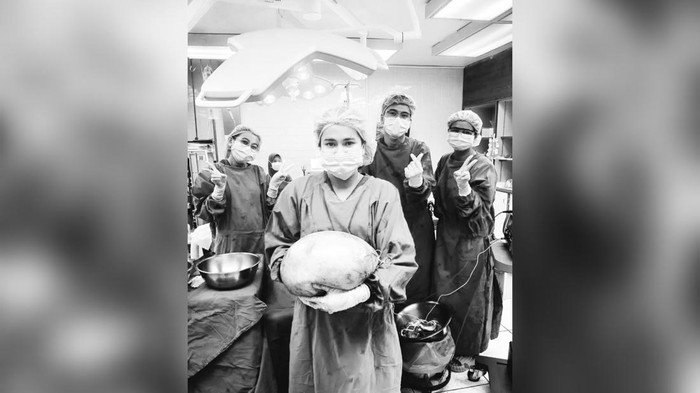 Seorang wanita di Thailand mengalami kesulitan bernapas dan perut buncit yang dikira penumpukan lemak. Ternyata, hasil pemeriksaan menunjukkan ada kista seberat 8 kg.