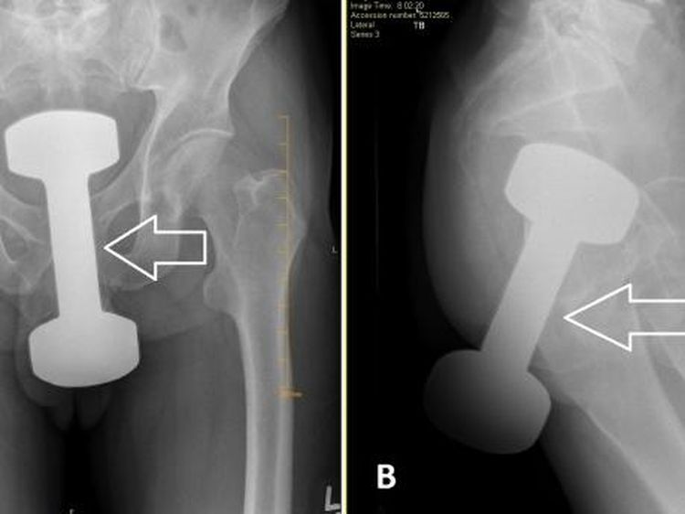Nggak Habis Pikir, Ini Foto Nyata Benda Aneh yang Ditemukan di Tubuh Pasien