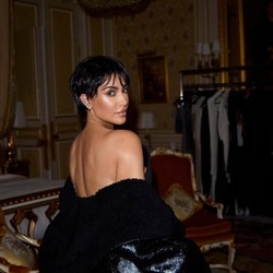 Kim Kardashian Alami Aneurisma Otak karena Stres, Singgung Kanye West