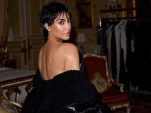 Kim Kardashian Alami Aneurisma Otak karena Stres, Singgung Kanye West