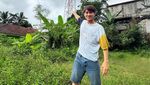 Reaksi Rizky Billar Luka Lama Dikorek Lagi