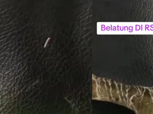 Kemenkes Tegur RSUD Cut Meutia Imbas Viral Bed Pasien Penuh Belatung