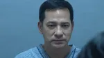 Ari Wibowo dan Alasan Lakukan Facelift di Korea Selatan