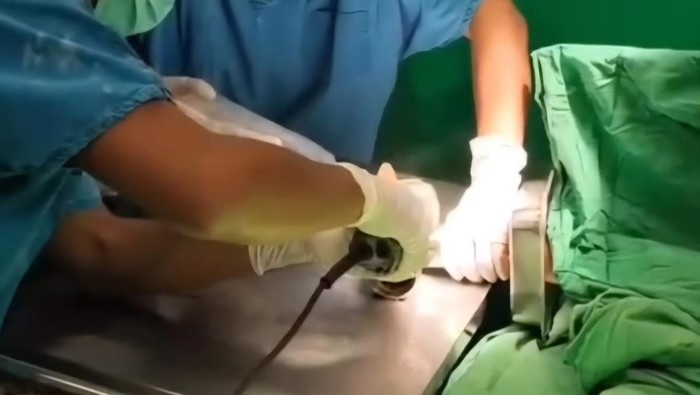 Tangan balita di Makassar terjepit mesin penggiling daging.