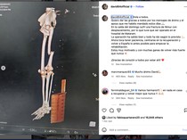 Pebalap Ini Alami Patah Tulang Paha Usai Crash di GP Mandalika