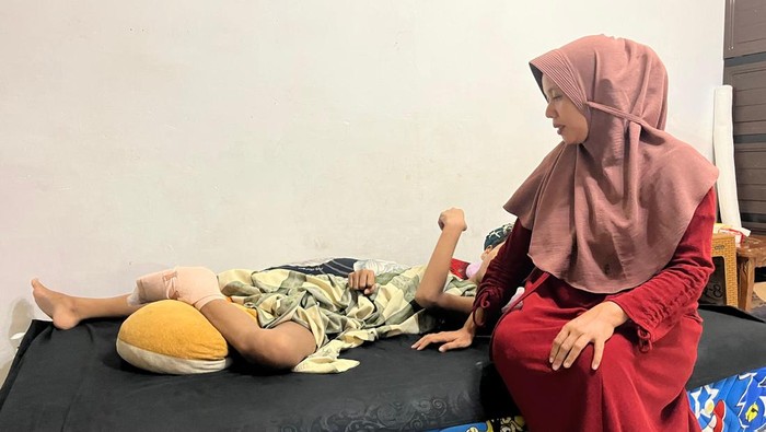 Kondisi telapak kaki bocah korban begal di Jambi memburuk, dan membutuhkan biaya operasi lanjutan