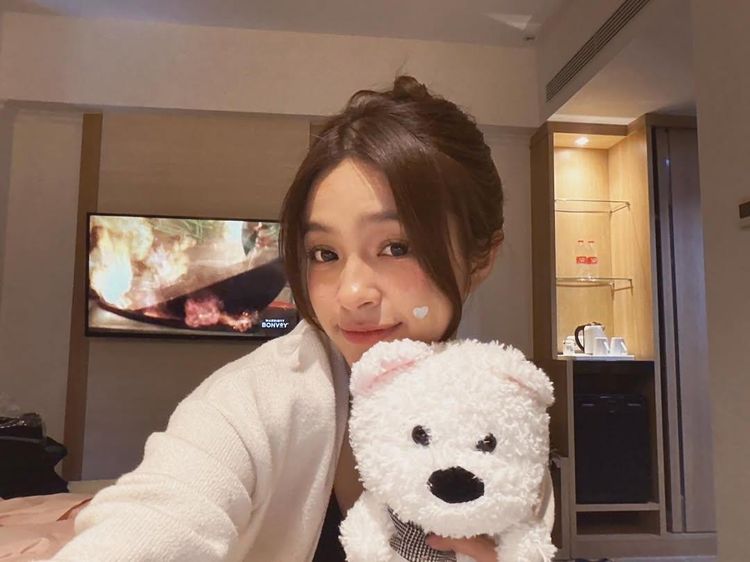 Elsa Japasal Soal Jadi Pelopor Artis Pede dengan Tempelan Jerawat