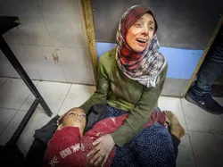 Foto Memilukan Konflik Gaza Memenangkan Penghargaan Fotografi 2025