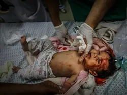 Foto Memilukan Konflik Gaza Memenangkan Penghargaan Fotografi 2025