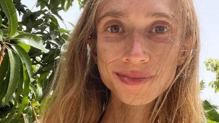 Video: Berat Badan Hanya 22 Kg, Wanita Ini Meninggal Usai Diet Ekstrem