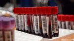 Ramai-ramai Donor Demi Penuhi Stok Kantong Darah