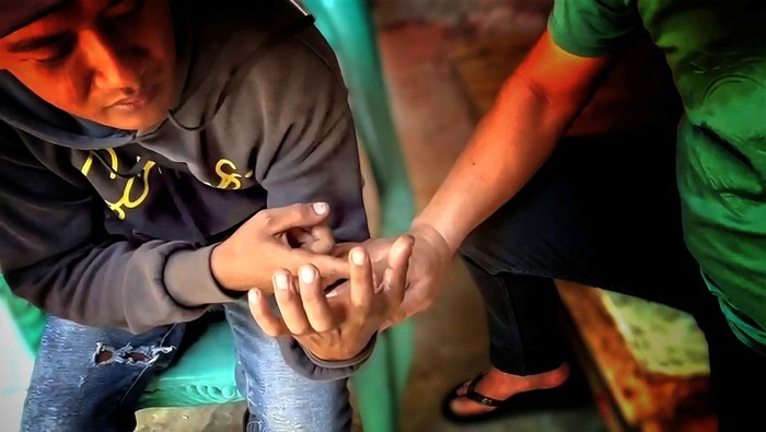 Edi menunjukan luka usai diseruduk dan digigit babi hutan
