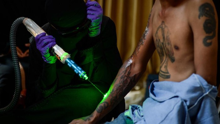 Program layanan hapus tato gratis di Tangerang Anggota Komunitas Berani Hijrah Baik menggunakan laser menghapus tato seorang pria di Masjid Jami Al Ihsaniyah, Tigaraksa, Kabupaten Tangerang, Banten, Minggu (12/10/2025). Program layanan hapus tato gratis yang menargetkan 50 orang dengan syarat setoran hafalan lima ayat surat Ar-Rahman tersebut rutin dilakukan dua bulan sekali guna memberikan kesempatan kepada warga yang ingin hijrah menjadi manusia yang lebih baik. ANTARA FOTO/Putra M. Akbar/tom.
