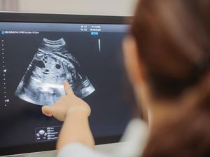 USG Tiap Bulan Bisa Bahayakan Janin, Benarkah? Begini Penjelasan Obgyn