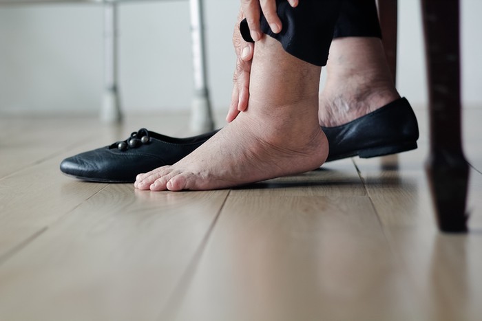 Kaki penderita diabetes.