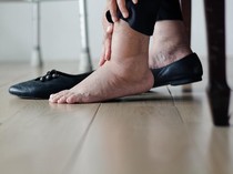 Waspada! Asupan Makanan Tinggi Gula Bisa Bikin Lipatan Kulit Menghitam