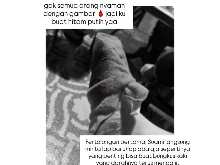 Asmirandah tergelincir di kamar mandi.