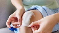 Jangan Cuma Ditunggu Kering! Ini Cara Mencegah Bekas Luka Kata Dokter Kulit
