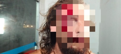 ED (33), WN AS yang menjadi korban penganiayaan di vila Desa Selong Belanak, Kecamatan Praya Barat, Lombok Tengah, NTB, Minggu (19/10/2025). (Dokumentasi warga)