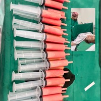 Beberapa waktu lalu artis Felicya Angelista menjalani prosedur Local Anesthetic Minimal-invasif Lipo-suction (LAMS). Prosedur tersebut dipilhnya untuk mengembalikan kepercayaan diri setelah melahirkan 2 orang anak. Foto: Instagram/@felicyangelista_