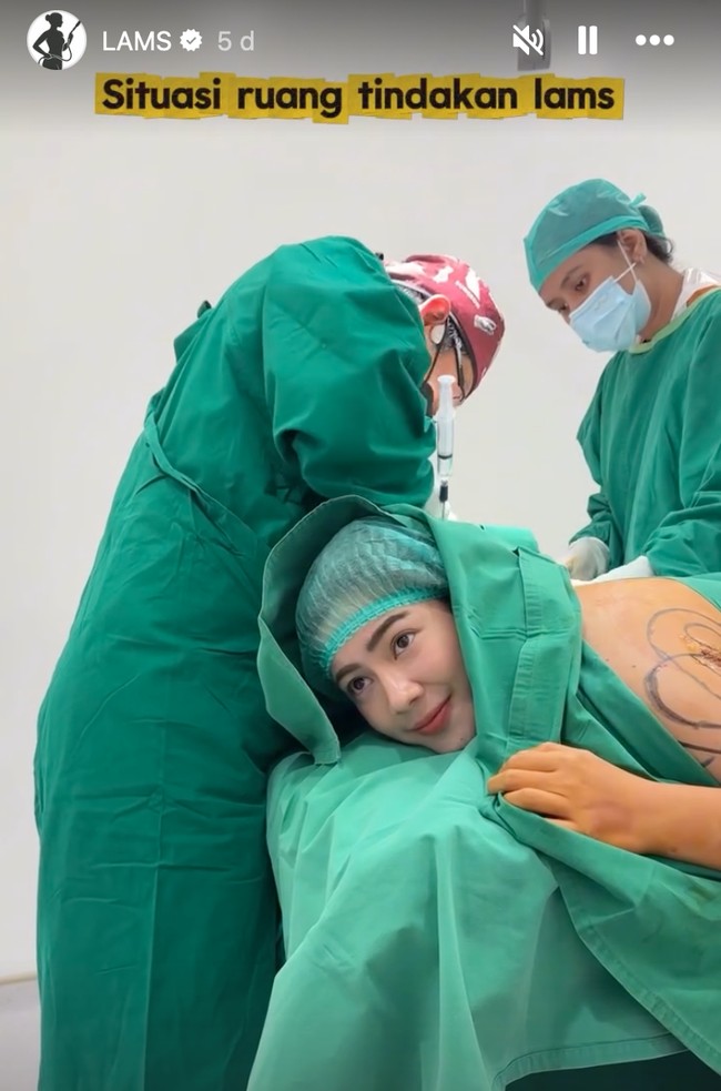 Melalui akun Instagram pribadinya Feli membagikan proses dirinya saat menjalani tindakan LAMS. Dengan keadaan sadar, Feli terlihat tetap nyaman sambil menonton drakor saat tindakan berlangsung. Foto: Instagram/@felicyangelista_