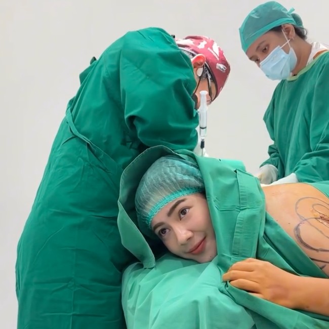 8 Foto Felicya Angelista Jalani Sedot Lemak, Makin Langsing Turun BB 2 Kg